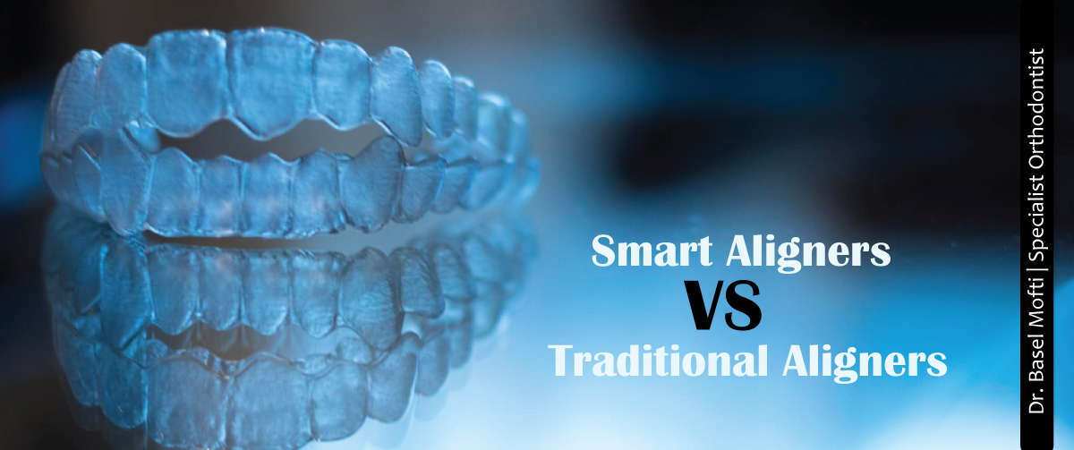Smart-Aligners-vs-Traditional-Aligners