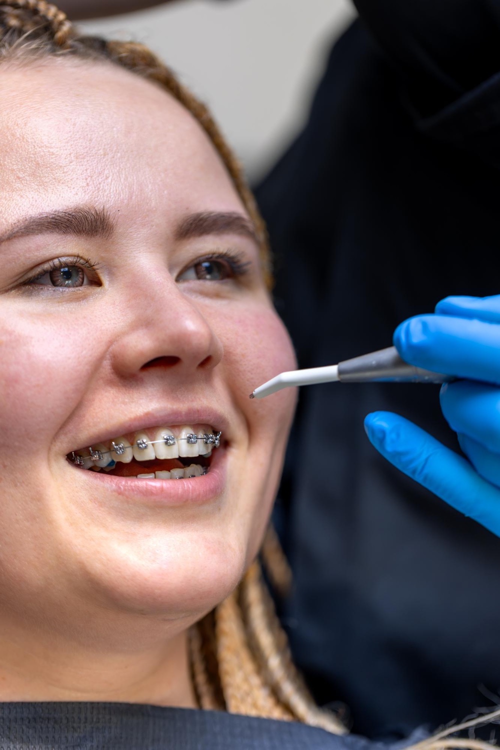Braces Dubai
