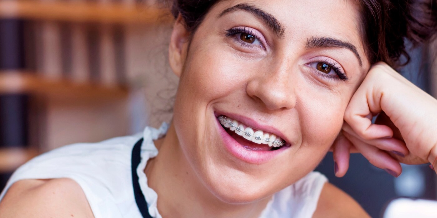 Orthodontic Braces - in Dubai