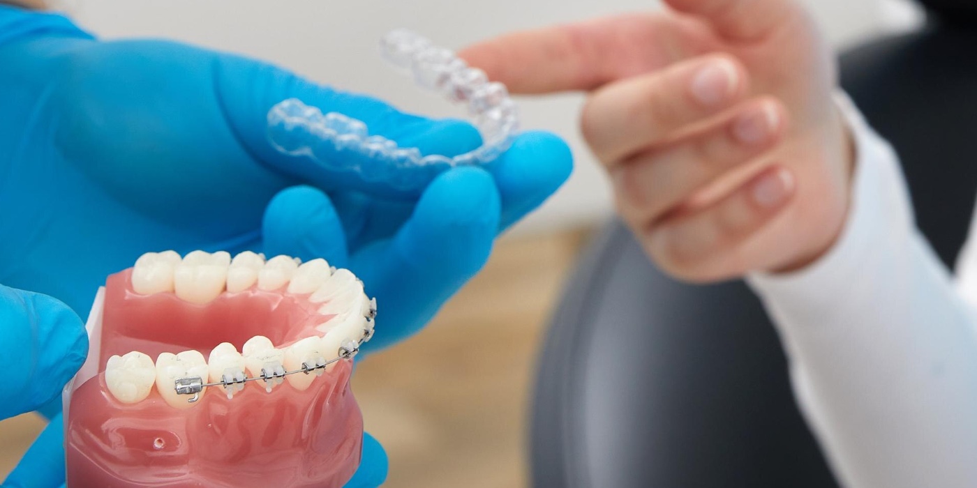 Read more about the article Orthodontic Braces vs Invisalign Dubai-2026