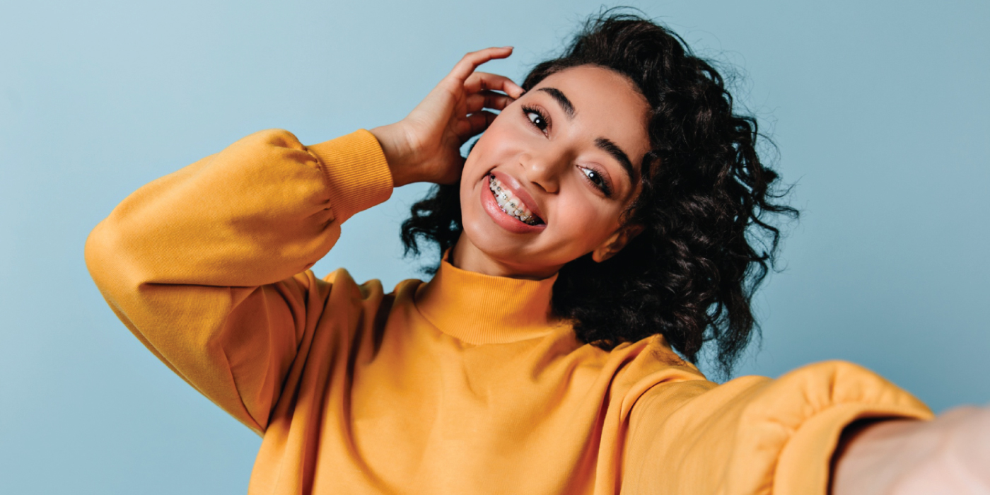 Women-Smile-Makeover-Braces-Dubai