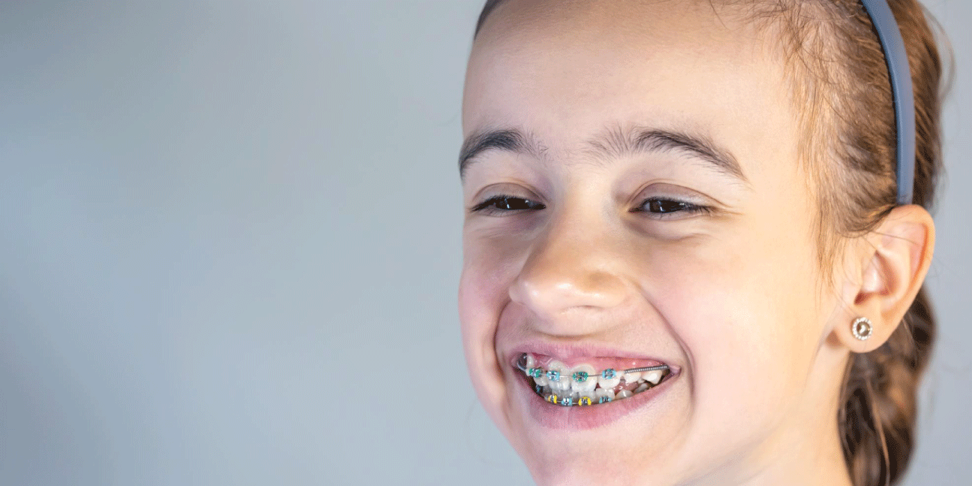 Children's-Braces-in-Dubai