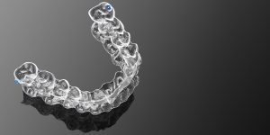 Invisalign-Clinic-Price-Dubai