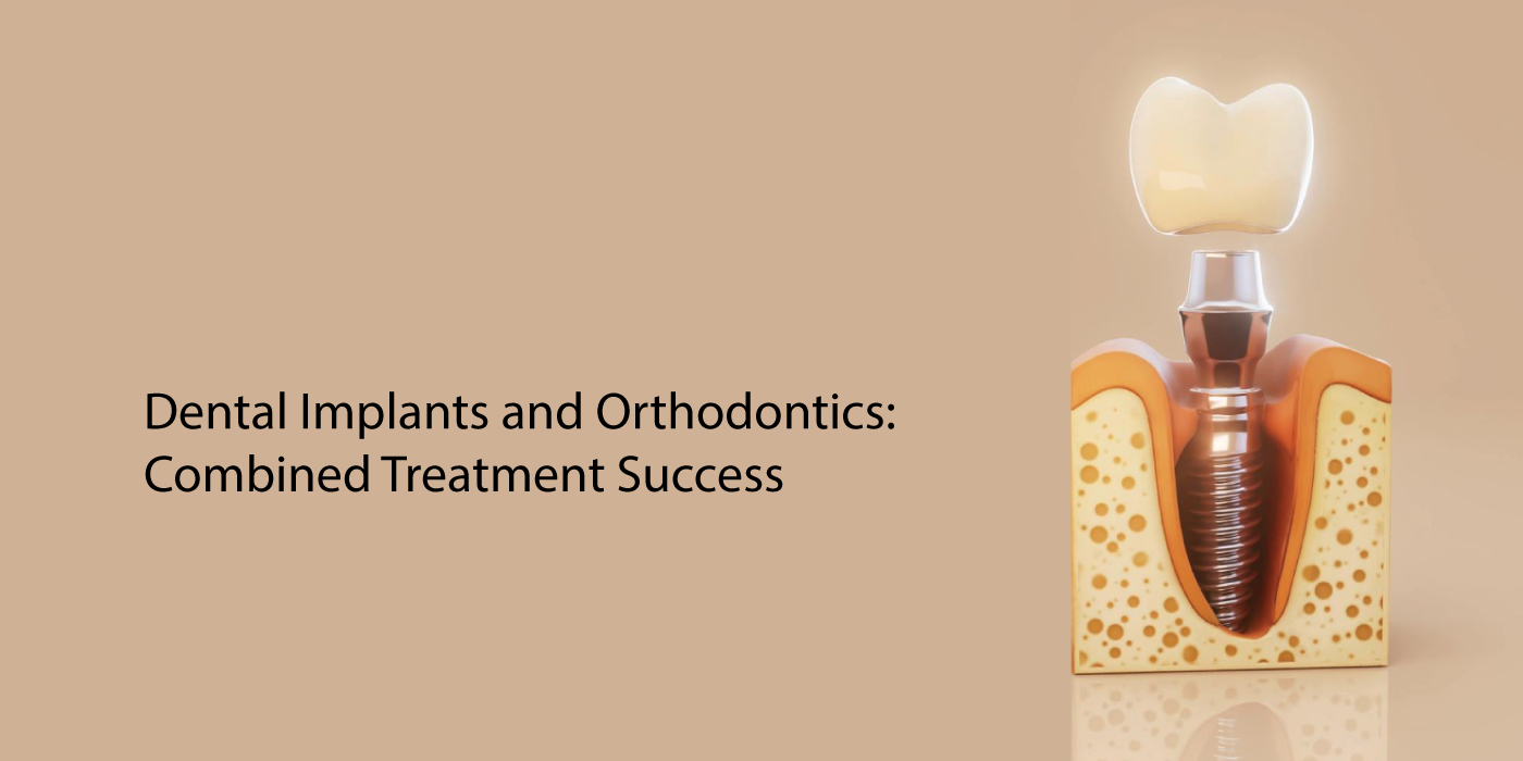 Read more about the article Missing Teeth and Crooked Teeth? How Dental Implants and an Orthodontist in Dubai Can Fix Both