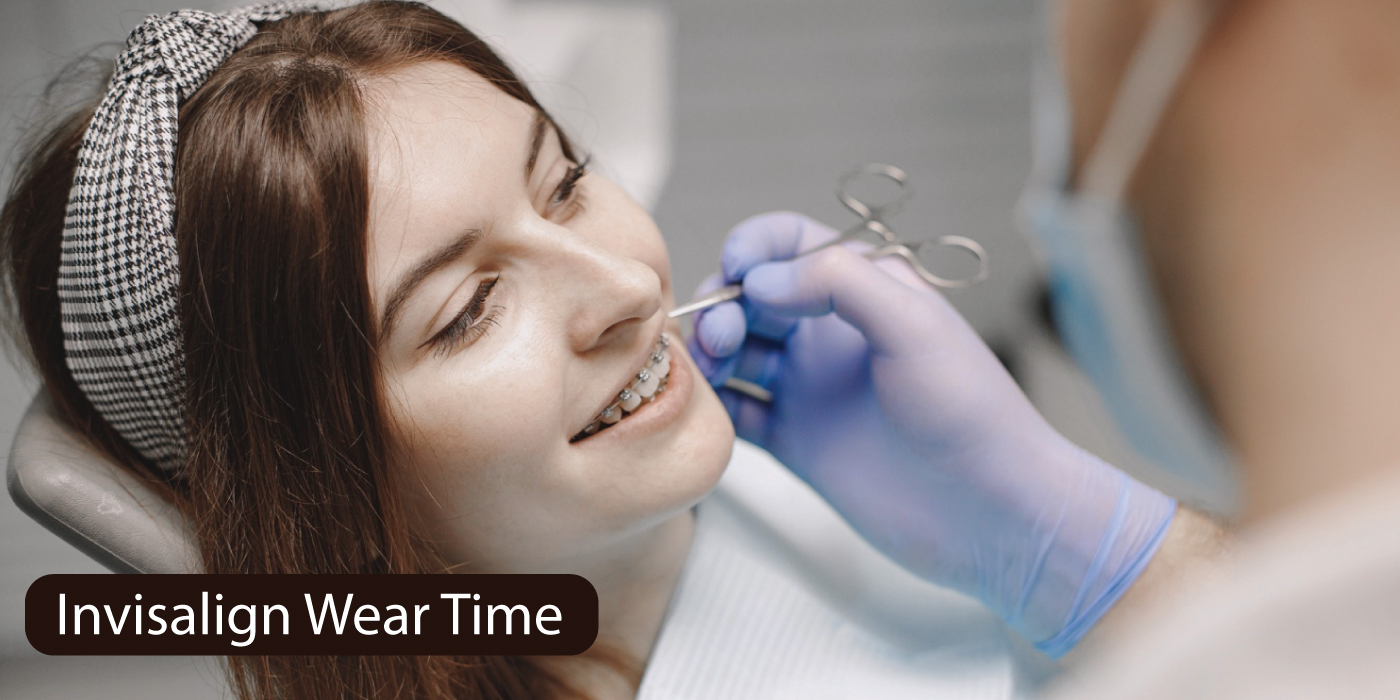 Invisalign-Wear-Time-Basel-Mofti
