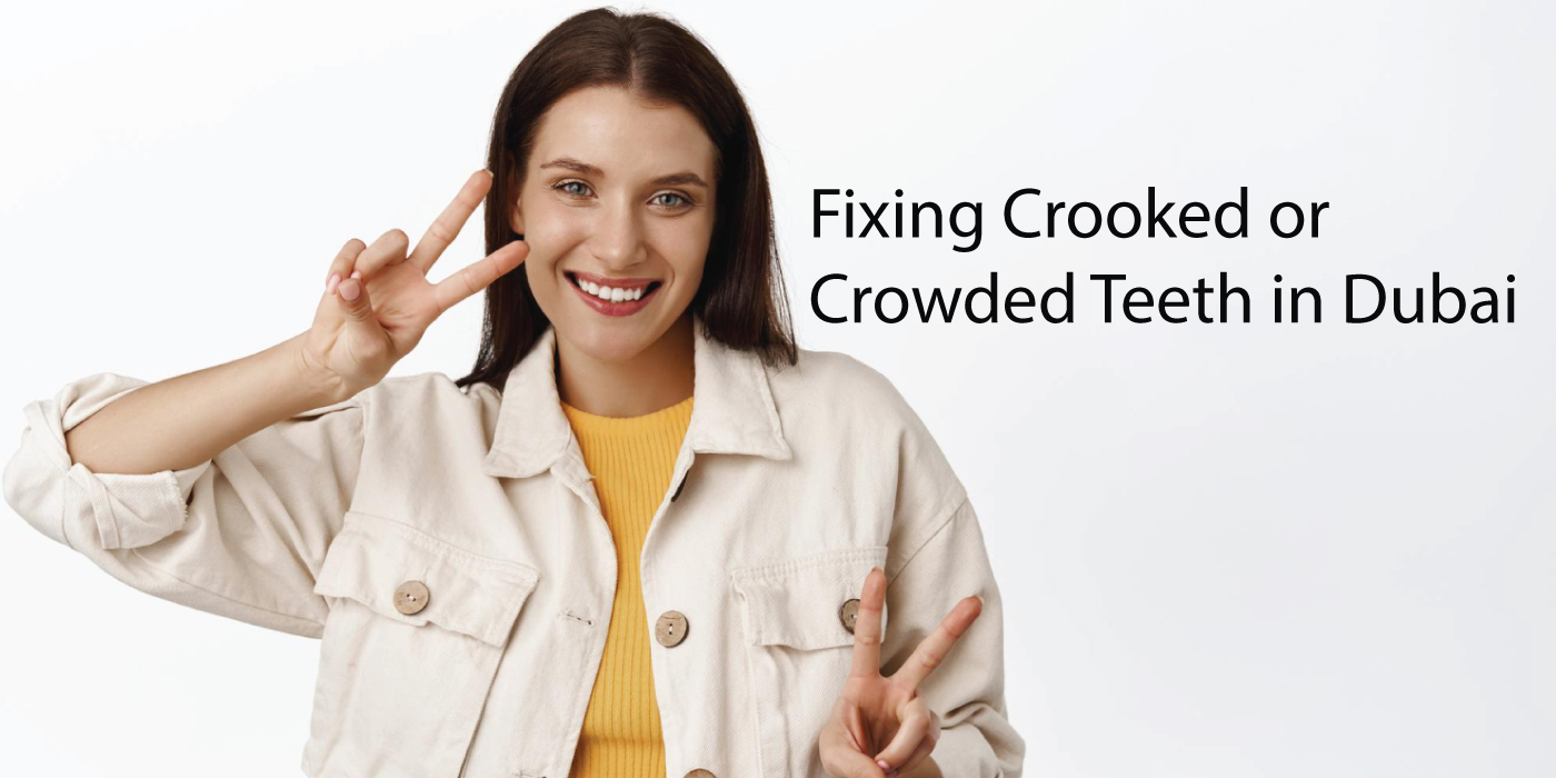 Crooked-Teeth-Treatment-Dubai