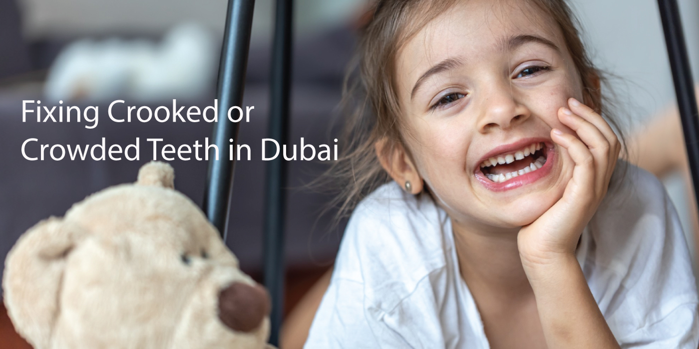 Fixing-Crooked-or-Crowded-Teeth-in-Dubai