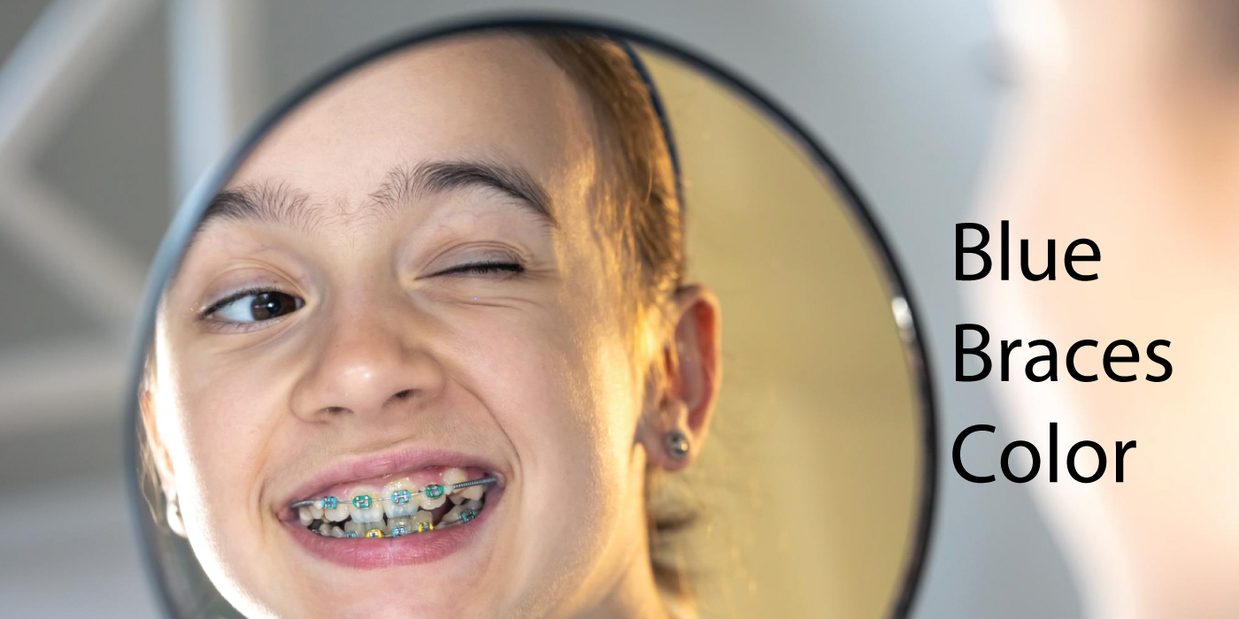 Blue-Braces-Color-in-Dubai