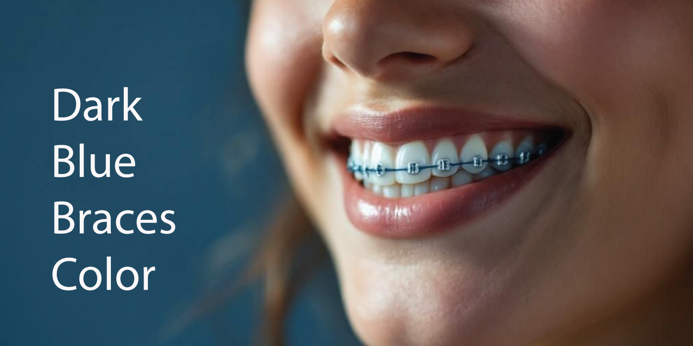 Dark-Color-Braces-Dubai
