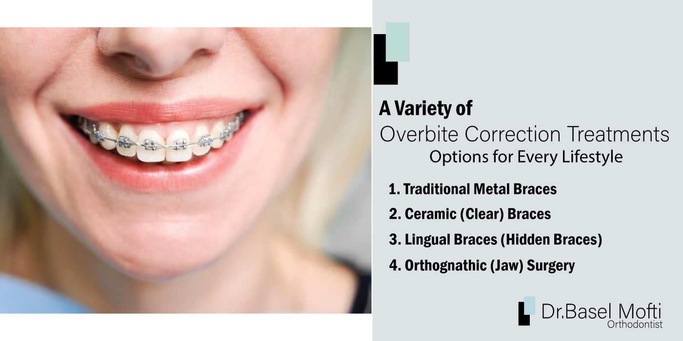 A-Variety-of-Overbite-Correction-Treatments