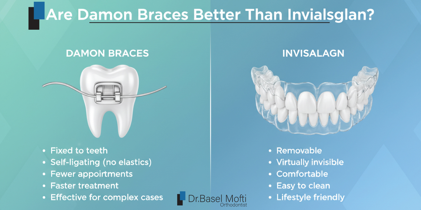 Are-Damon-Braces-Better-Than-Invisalign