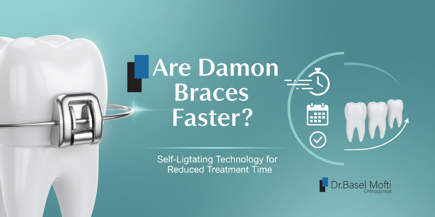 Are-Damon-Braces-Faster