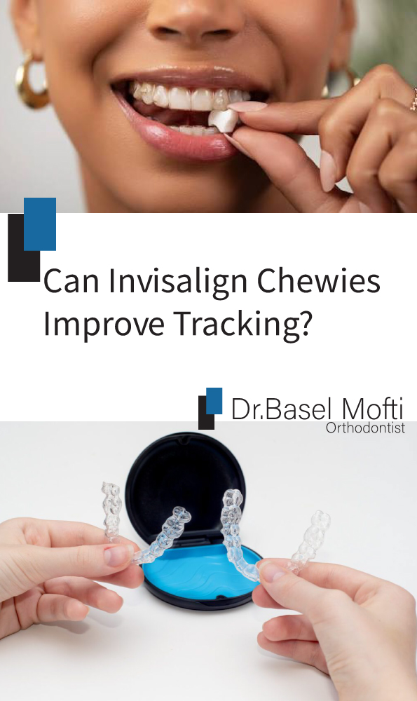 Can-Invisalign-Chewies-Improve-Tracking