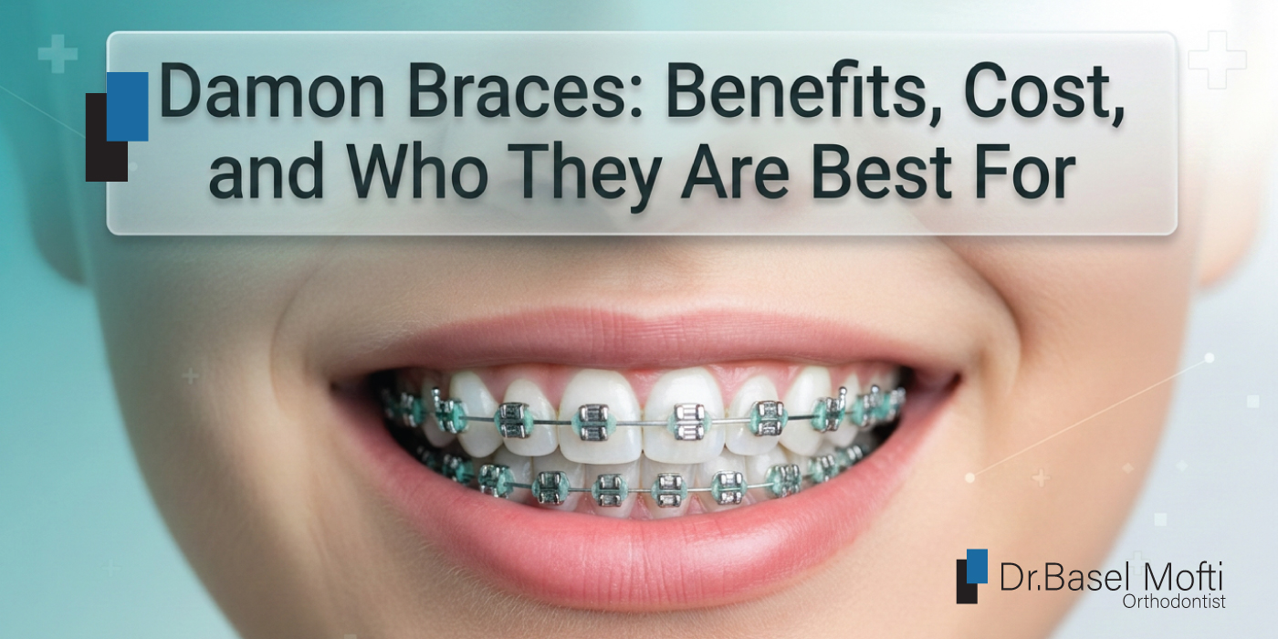 Read more about the article Damon Braces Dubai Cost & Guide | Benefits & Prices