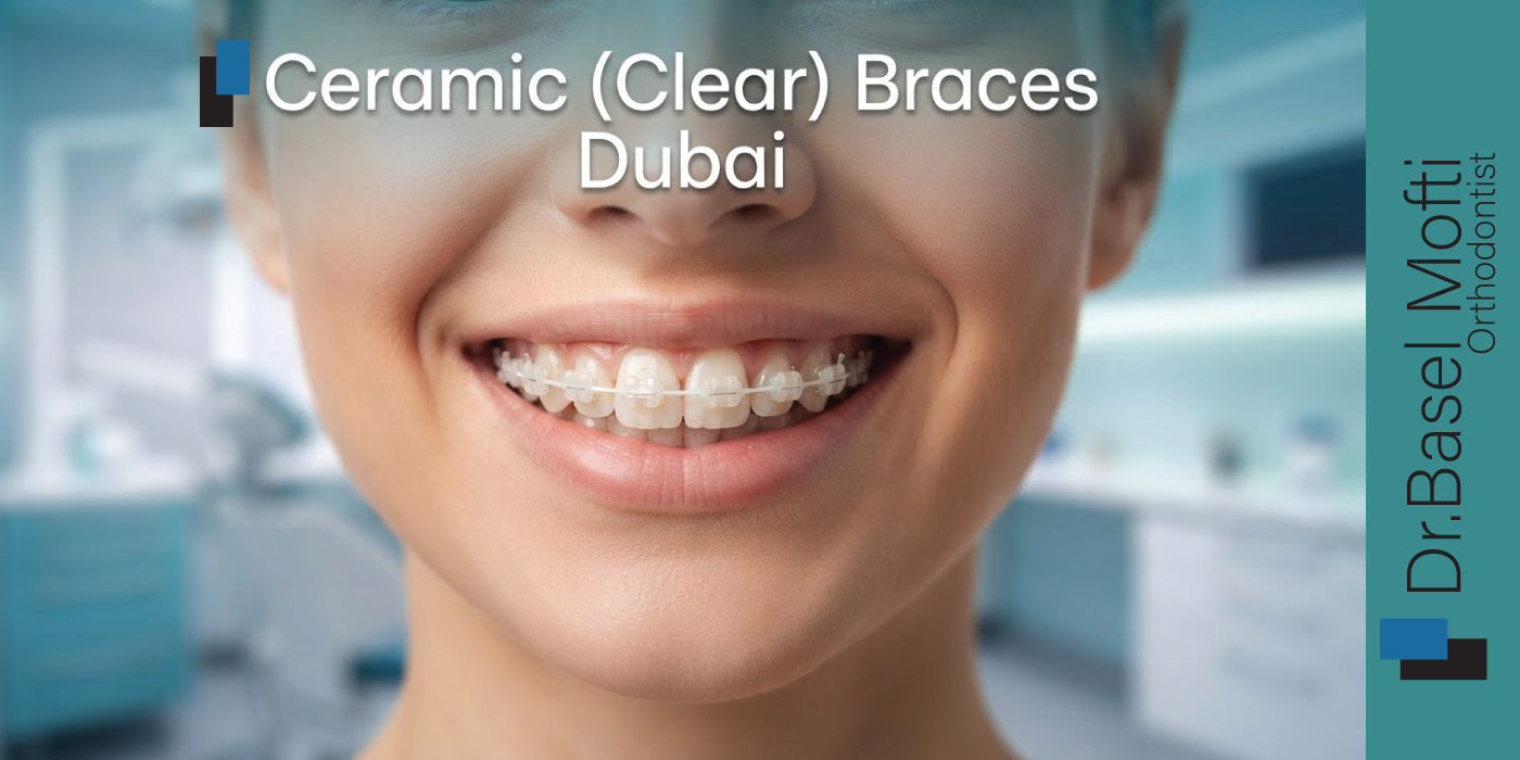 Ceramic-(Clear)-Braces-Dubai