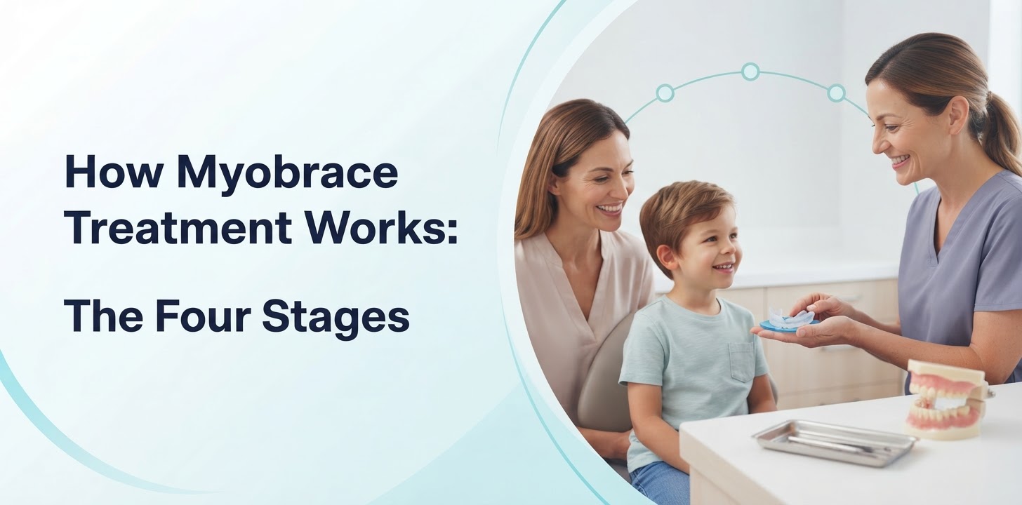 How Myobrace Treatment Works The Four Stages