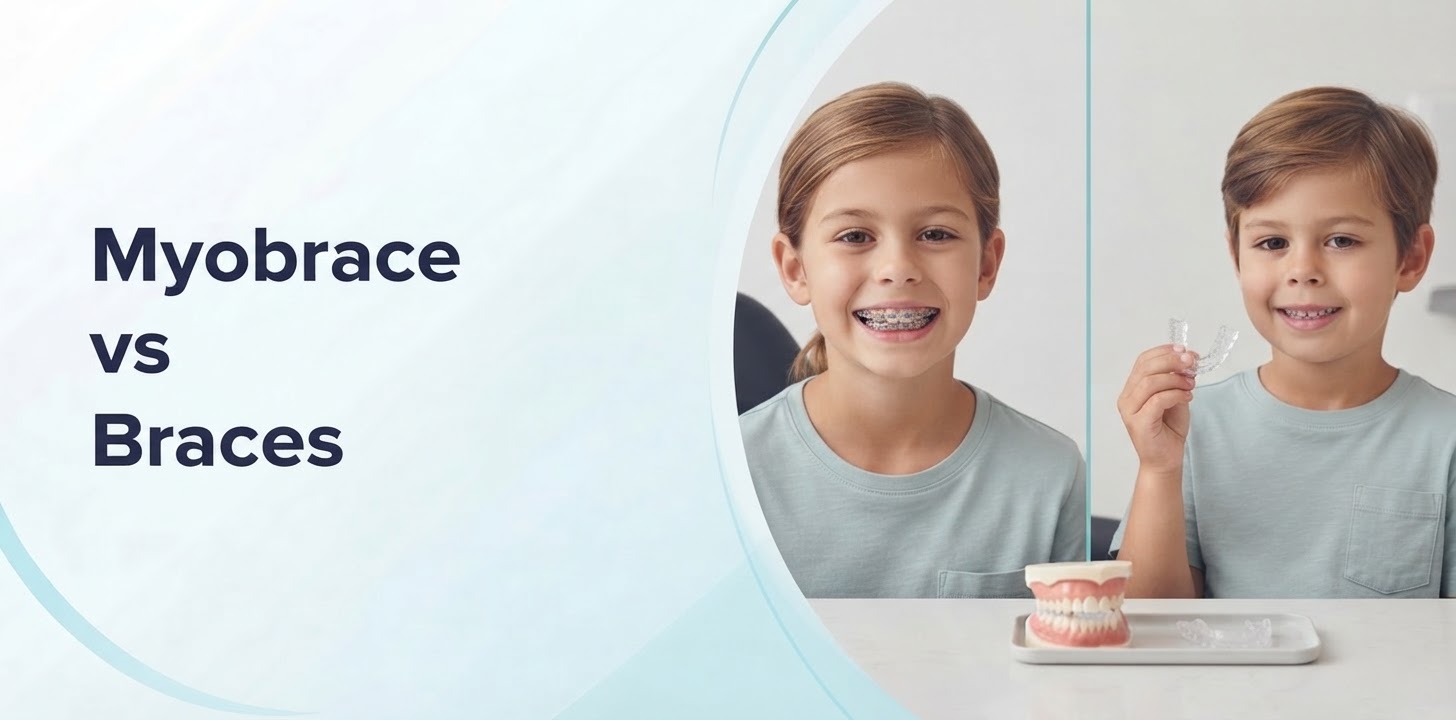 Myobrace vs Braces